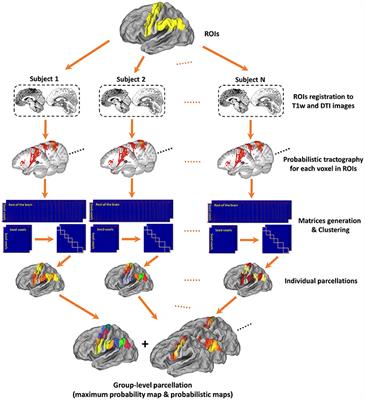 ATPP: A Pipeline for Automatic Tractography-Based Brain Parcellation